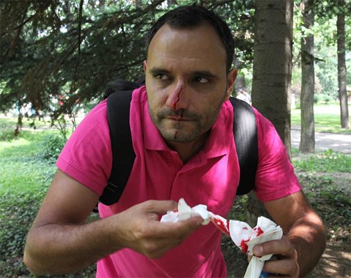 Фен на ЦСКА счупи носа на фоторепортер