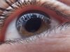 Страдащите от астма и сенна хрема са с по-висок риск от перде на очите