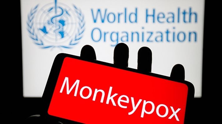 СЗО обяви извънредна ситуация за здравето в световен мащаб заради маймунската шарка