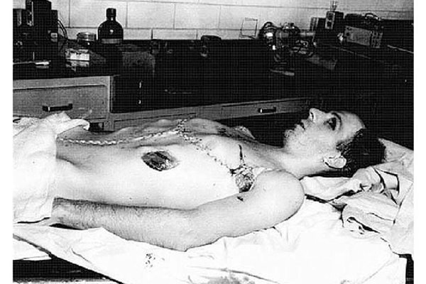 Тялото на Осуалд на масата за аутопсия 2 дни след убийството на Кенеди.