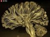 Китайски учени планират да създадат най-ясната триизмерна карта на човешкия мозък