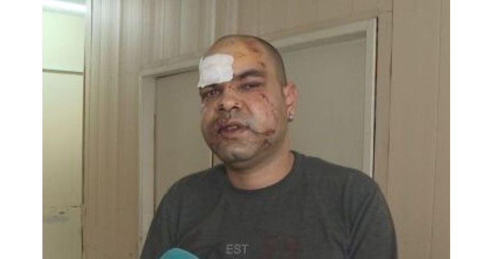 They detained the man who beat up a medic from the Vratsa emergency service