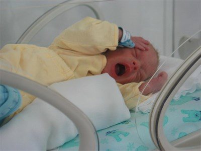 Недоносени бебета имат често проблеми с дишането
Снимка: Архив