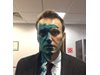 Навални: Оперираха окото ми в Испания, но зрението ми ще се възстанови след месеци