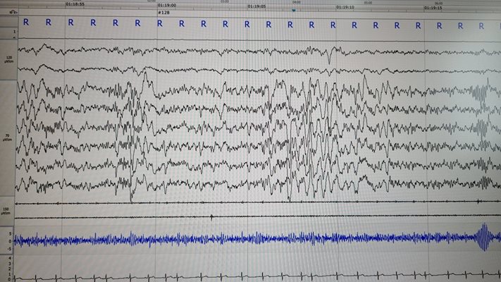 Данните за работата на мозъка са снети със съвременна апаратура. 
СНИМКА: ЛИЧЕН АРХИВ НА Д-Р НЕЙКО НЕЙКОВ
