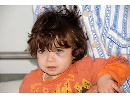 Двегодишната Димитринка е настанена в бургаската неврохирургия.
СНИМКА: ЕЛЕНА ФОТЕВА