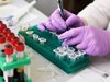 Работничка от шивашки цех в Русе е заразена с коронавирус