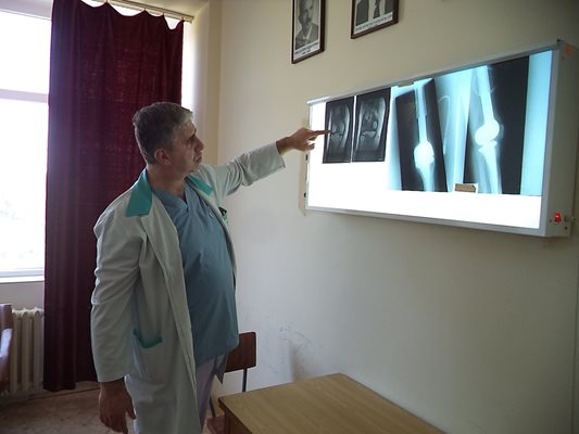 Проф. Ставрев показва рентгеновите снимки на пациентката с тумор в крака