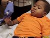 Първата трансплантация на две ръце на дете е успешна (Видео)
