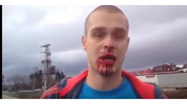 ЖЕРТВА: Васил Наумов изгуби някоко предни зъба в неравния сблъсък с мутрите.