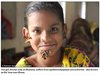 Момиче от Бангладеш вероятно е първият случай на човек дърво сред жените (Видео)