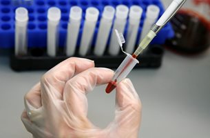 Ваксина срещу СПИН намалява риска от зараза със 79%
