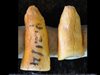 Археолози откриха най-старите зъбни пломби