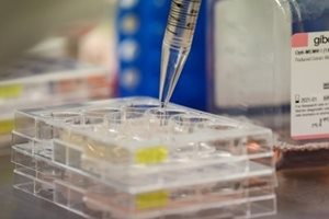 77 нови с коронавирус в Пазарджишко, 
трима са починали