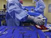 Лекари извадиха 5-метрова тения от тялото на китаец, фен на сурово месо