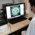 Учен разглежда микроскопско изображение на кръвоносен съд, заобиколен от ракови тъкани, като част от изследване на рака на мозъка.