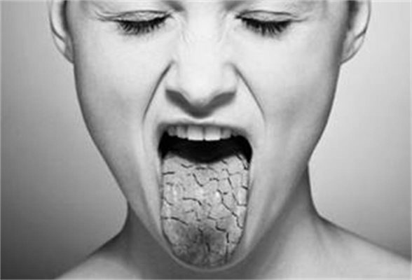 Устата пресъхва, езикът залепва за небцето - може би е болест