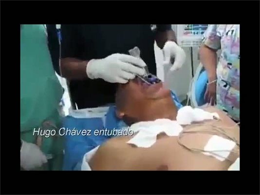 Шокиращо видео на умиращия Уго Чавес (видео 18+)