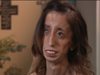 "Най-грозната жена" вдъхновява хиляди с историята си (видео)