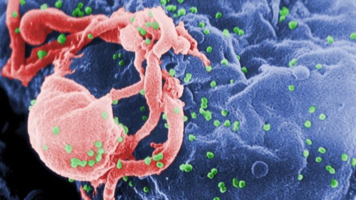 Вирусът ХИВ
