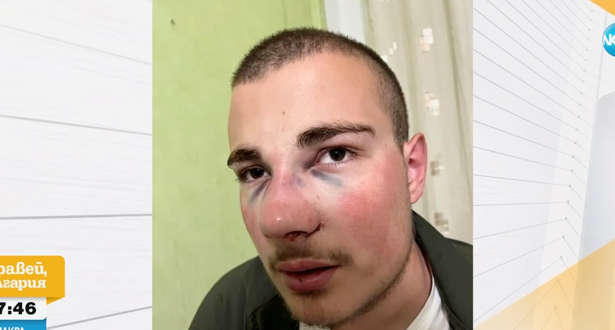 Пребиха жестоко с бокс 18-годишен в село Марица