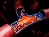Запушените артерии могат да доведат до инсулт и инфаркт, как да ги изчистим