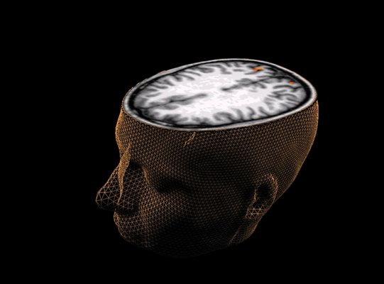 Човешки мозък, сниман със сканираща технология. Тя се използва от учените, за да наблюдават дълбоко в неговите зони.