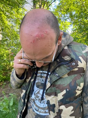 Димитър Стоянов показва ранената си глава.

СНИМКА: ФЕЙСБУК