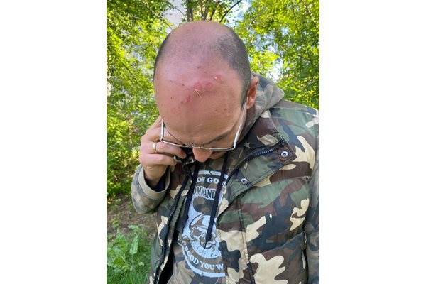 Димитър Стоянов показва ранената си глава.

СНИМКА: ФЕЙСБУК