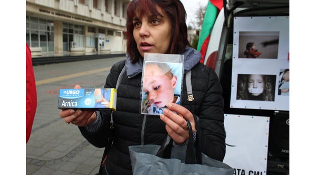 Тедора Налбантова показва снимка на бития от учителката си внук Кристиян и крема за стави, който педагожката дала, за да мажат нараняванията на детето