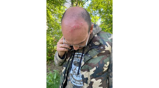 Селгито, което Стоянов си пусна днес във фейсбук. На него показва рана на главата си.