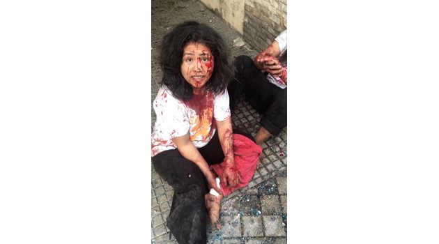 Младо момиче седи окървавено на тротоар край пристанището на Бейрут. Десетки ливанци отчаяно издирват близките си след взрива.