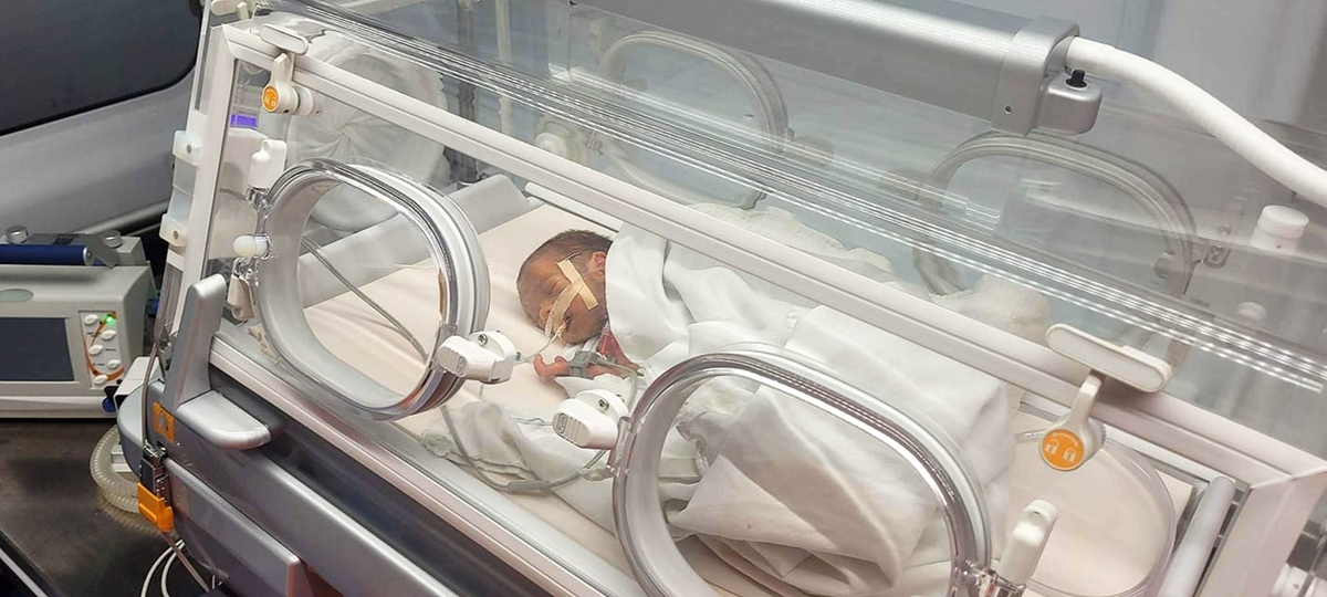 Медици от Пловдив се борят за живота на бебе с тегло 1,2 кг