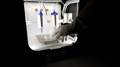 Отпечатване на кожа с помощта на 3D принтер и присаждането й на пациент ще направят във Франция. Снимка: Архив