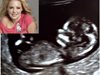Актрисата Катрин Хейгъл обяви, че е бременна със снимка от ултразвук