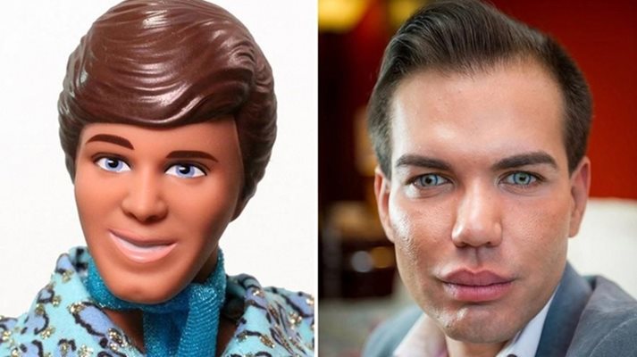 След 42 разкрасителни интервенции - 
нос затрива живата кукла Кен