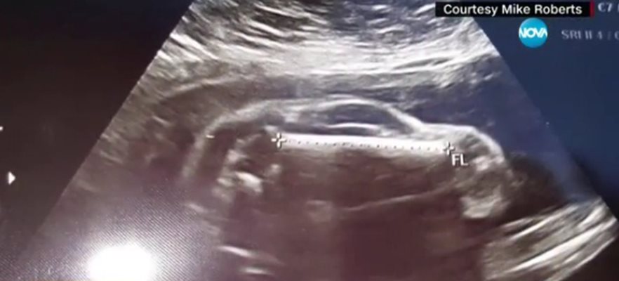 Млада жена в САЩ е "бременна с автомобил" (видео)