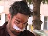 Французинът, пребит от шофьор: Започна да ме преследва (Видео)