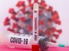 "Модерна" срещу южноафриканския вариант на коронавируса е готова за клинични изпитвания