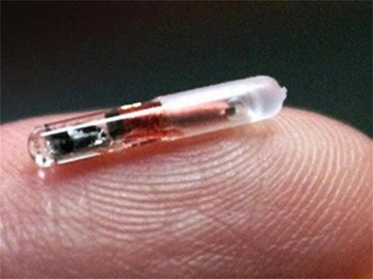 Така изглежда имлантирания чип на доктор Марк Гасън.