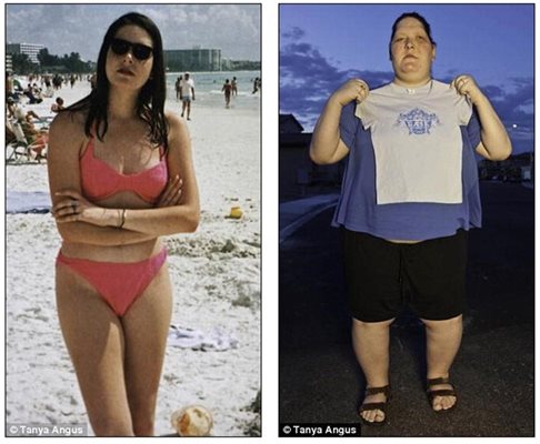 Таня преди и след като се разболява от коварнат болест
Снимки: Дейли мейл