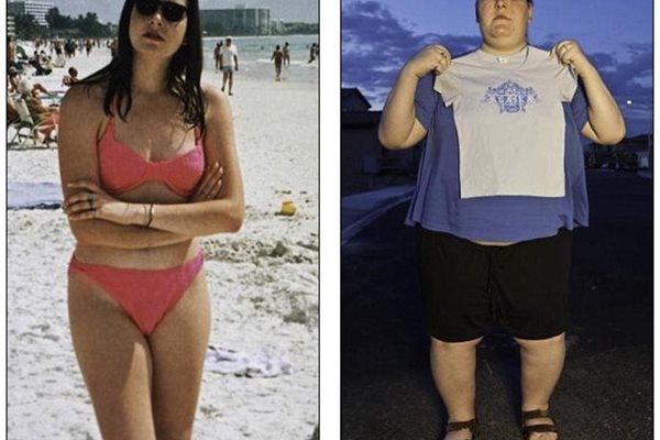 Таня преди и след като се разболява от коварнат болест
Снимки: Дейли мейл