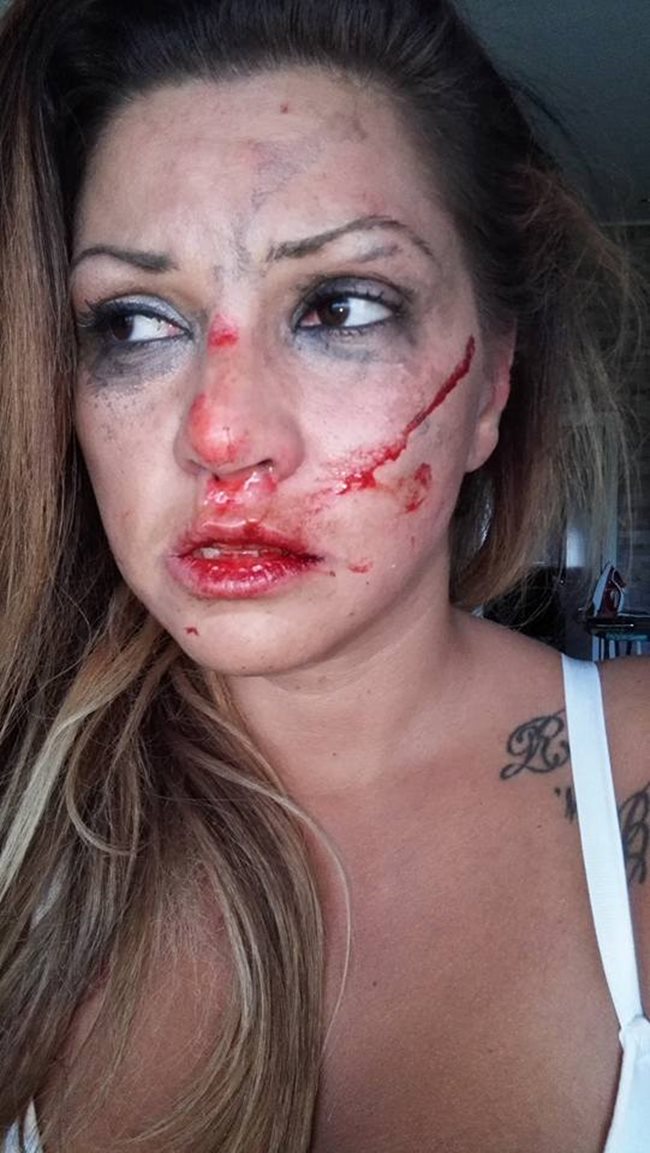 Окървавеното лице на Сани Алекса. Тази снимка е публикувана в профила на певицата във фейсбук.