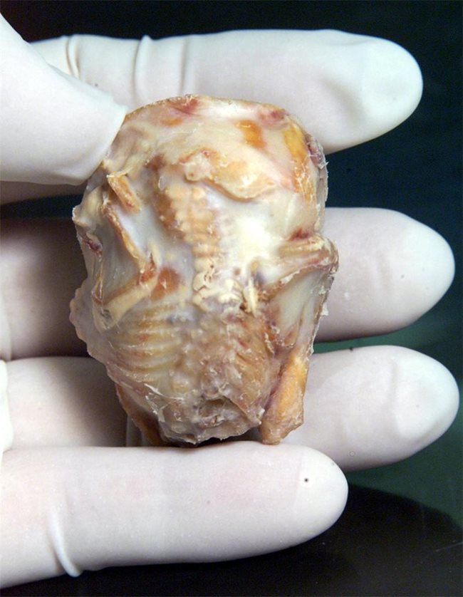Така изглеждат вкаменените бебета. Този мумифициран плод е изваден в болница в Тайпе от 76-годишна жена. СНИМКА: РОЙТЕРС 