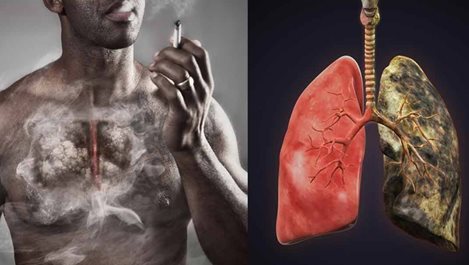 Естествено пречистване на белия дроб от катран при пушачи