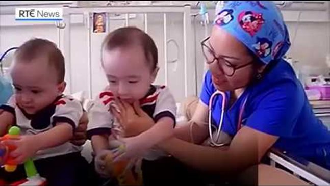 Сиамски близнаци се прибират у дома след успешна операция по разделяне (Видео)