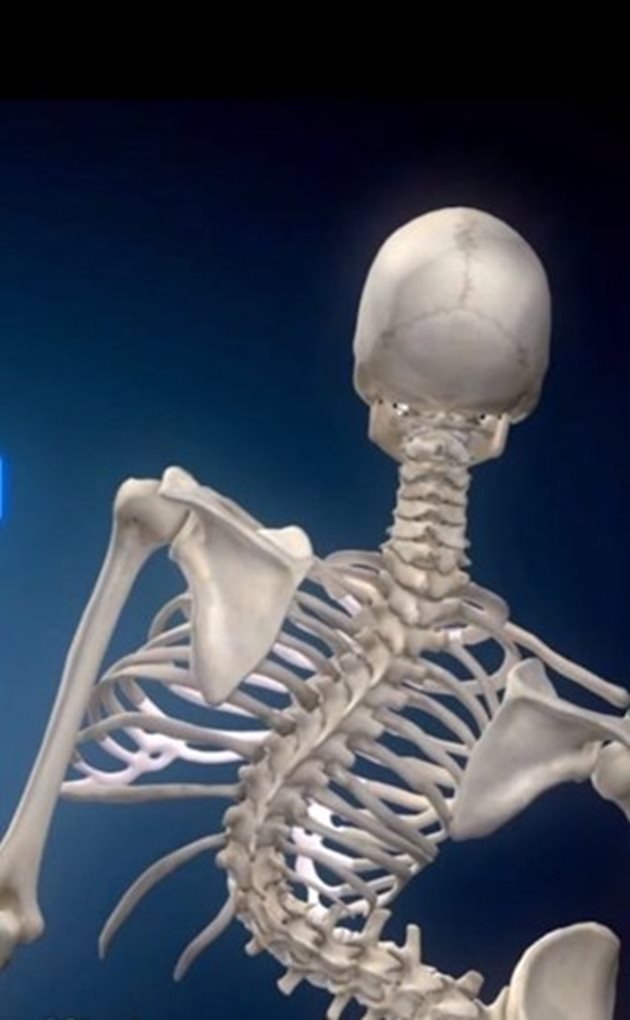 Илюстрацията онагледява как се променя скелетът без лечение.