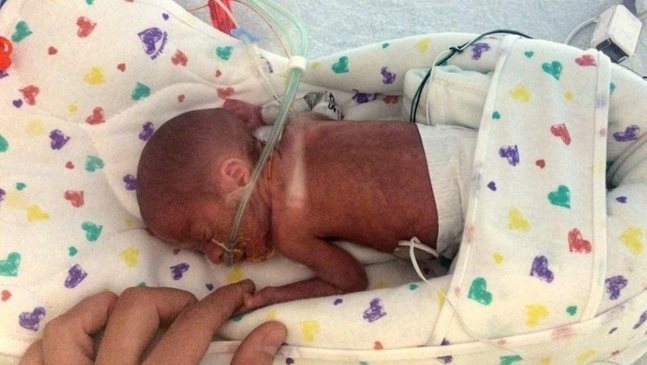 Бебе се ражда на круизен кораб, на 14 часа път от болница. Тежи само 680 грама, но оцелява