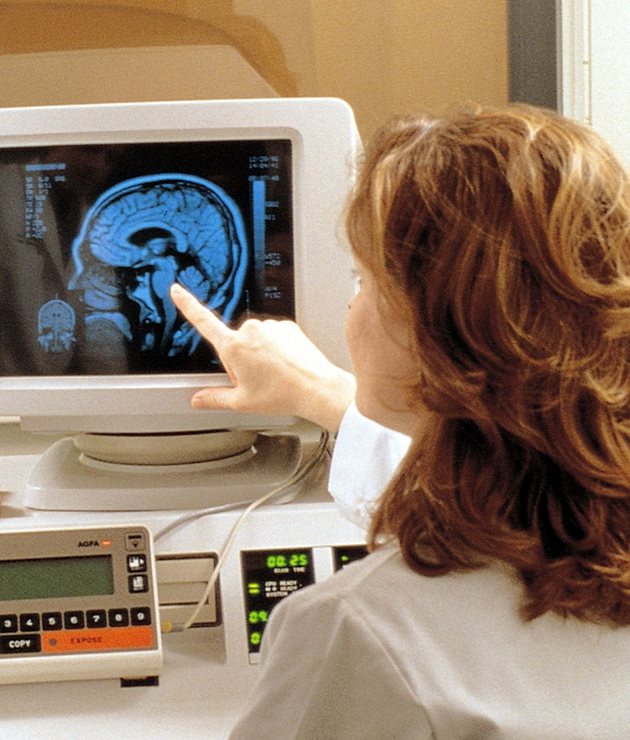 Образната диагностика ориентира лекарите за състоянието на мозъчните съдове.