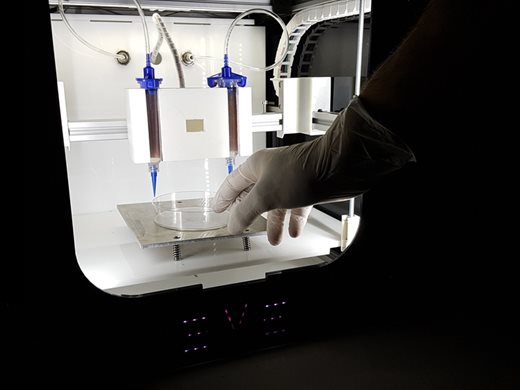 Франция се подготвя за световна премиера: присаждането на кожа,
отпечата на 3D принтер